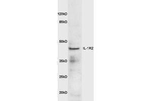 IL1R2 antibody  (AA 301-398)