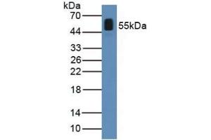 Detection of ANGPTL2 in Human Serum using Polyclonal Antibody to Angiopoietin Like Protein 2 (ANGPTL2) (ANGPTL2 Antikörper  (AA 267-493))