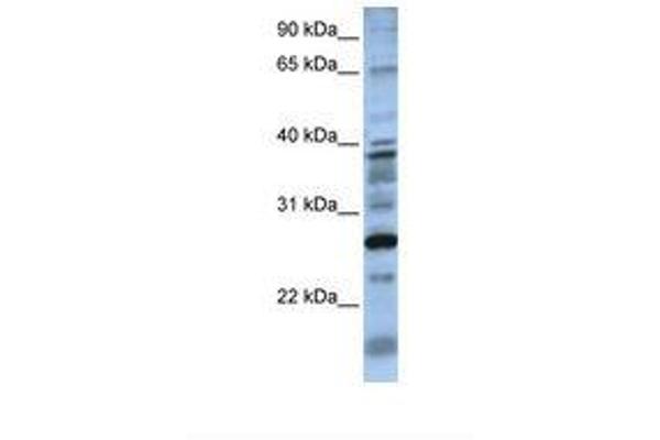DOLPP1 Antikörper  (N-Term)