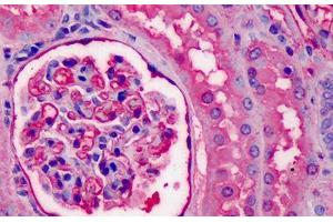 Human Kidney: Formalin-Fixed, Paraffin-Embedded (FFPE) (APOA1 Antikörper)
