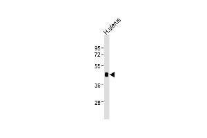 Western Blotting (WB) image for anti-Wingless-Type MMTV Integration Site Family, Member 7A (WNT7A) antibody (ABIN6243408)
