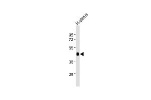 Anti-WNT7A Antibody at 1:2000 dilution + human uterus lysates Lysates/proteins at 20 μg per lane. (WNT7A Antikörper)