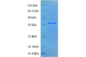MDH (AA 1-312), (full length) protein (His tag)