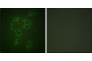 Immunofluorescence analysis of HepG2 cells, using CBL (Phospho-Tyr700) Antibody. (CBL Antikörper  (pTyr700))