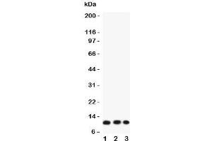 Western blot testing of Eotaxin 3 antibody and Lane 1:  COLO320;  2: A549;  3: HT1080 lysate. (CCL26 Antikörper  (AA 24-94))
