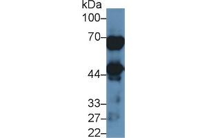Rabbit Detection antibody from the kit in WB with Positive Control: Human lung lysate.