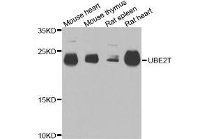 Western blot analysis of extracts of various cells, using UBE2T antibody. (Ube2t Antikörper)
