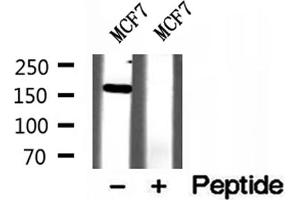 Western blot analysis of extracts of MCF7 cells, using ZCCHC11 antibody. (ZCCHC11 Antikörper  (Internal Region))