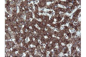 Immunohistochemistry (IHC) image for anti-Acetyl-CoA Acyltransferase 2 (ACAA2) antibody (ABIN1495727) (ACAA2 Antikörper)