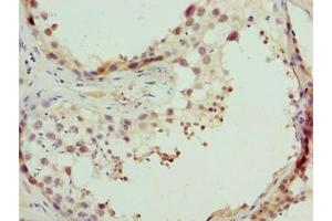 Immunohistochemistry of paraffin-embedded human testis tissue using ABIN7148653 at dilution of 1:100 (CPXCR1 Antikörper  (AA 1-301))