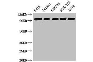 Western Blot Positive WB detected in: Hela whole cell lysate, Jurkat whole cell lysate, HEK293 whole cell lysate, NIH/3T3 whole cell lysate, A549 whole cell lysate All lanes: DDR2 antibody at 3. (DDR2 Antikörper  (AA 447-540))