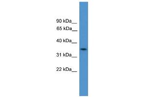 WB Suggested Anti-C4orf19 Antibody Titration:  0. (C4orf19 Antikörper  (N-Term))