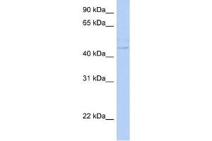 PSCD4 antibody used at 1 ug/ml to detect target protein.