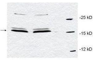 Western blot using  affinity purified anti-Pin1 antibody to detect endogenous Pin1 in HeLa whole cell lysates.