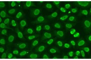 Immunofluorescence analysis of HeLa cells using FEN1 Polyclonal Antibody (FEN1 Antikörper)