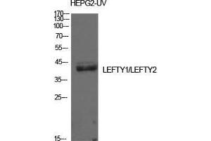 Western Blot (WB) analysis of HepG2-UV cells using Lefty Polyclonal Antibody. (LEFTY1 Antikörper  (Internal Region))