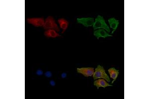 ABIN7094275 and ABIN7098322 staining HepG2 cells by IF/ICC.