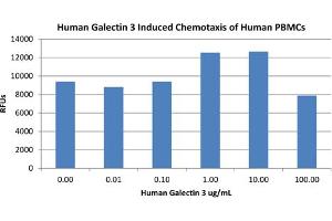 SDS-PAGE of Human Galectin-3 Recombinant Protein Bioactivity of Human Galectin-3 Recombinant Protein. (Galectin 3 Protein (LGALS3))