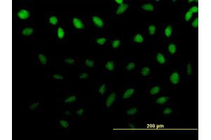 Immunofluorescence of purified MaxPab antibody to ZNF643 on HeLa cell. (ZNF643 Antikörper  (AA 1-432))