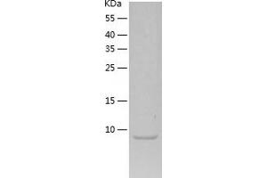 NT-ProBNP Protein (AA 27-76) (His tag)