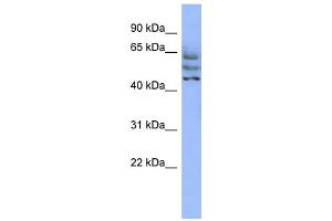 WB Suggested Anti-C3orf19 Antibody Titration: 0. (CCDC174 Antikörper  (Middle Region))