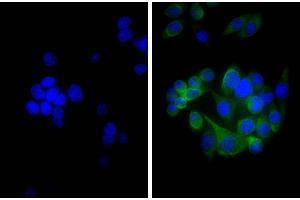 Human pancreatic carcinoma cell line MIA PaCa-2 was stained with Mouse Anti-Cytokeratin 18-UNLB, and DAPI. (Ziege anti-Maus Ig (Chain kappa) Antikörper (Biotin))
