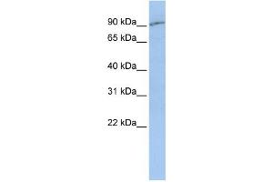 WB Suggested Anti-SLC15A2  Antibody Titration: 0. (SLC15A2 Antikörper  (Middle Region))