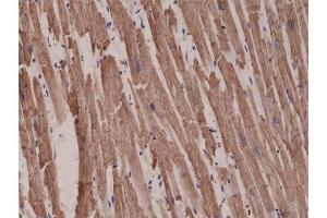 Immunohistochemical staining (Formalin-fixed paraffin-embedded sections) of human heart with ACTC1 monoclonal antibody, clone RM257  at a 1:1000 dilution. (ACTC1 Antikörper  (N-Term))