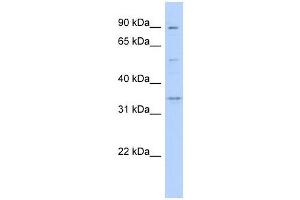 WNT9B antibody used at 1 ug/ml to detect target protein. (WNT9B Antikörper  (Middle Region))