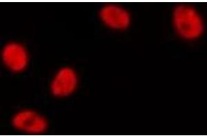 ABIN6267504 staining HeLa? (STAT3 Antikörper  (pTyr705))