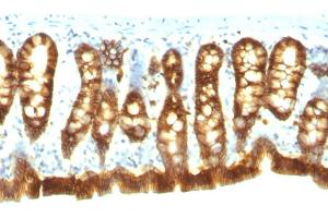 Formalin-fixed, paraffin-embedded Rat Colon stained with Ep-CAM Monoclonal Antibody (Epcam/1158). (EpCAM Antikörper)