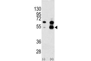Western Blotting (WB) image for anti-Vascular Endothelial Growth Factor A (VEGFA) (AA 66-95) antibody (ABIN3029576)