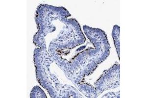 Immunohistochemical staining of human fallopian tube with CROCC polyclonal antibody  shows strong membranous positivity in ciliated cells.