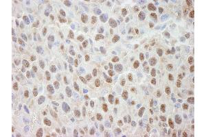 Immunohistochemistry (IHC) image for anti-Cullin 4A (CUL4A) (C-Term) antibody (ABIN7448505) (Cullin 4A Antikörper  (C-Term))