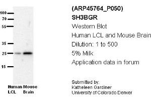 Image no. 2 for anti-SH3 Domain Binding Glutamic Acid-Rich Protein (SH3BGR) (N-Term) antibody (ABIN2782355) (SH3BGR Antikörper  (N-Term))