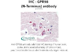 Image no. 1 for anti-G Protein-Coupled Receptor 98 (Gpr98) (Extracellular Domain), (N-Term) antibody (ABIN1735203) (Gpr98 Antikörper  (Extracellular Domain, N-Term))