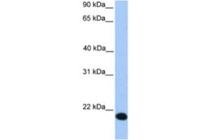 Western Blotting (WB) image for anti-Zinc Finger Protein 833 (ZNF833) antibody (ABIN2463333) (LOC401898 Antikörper)