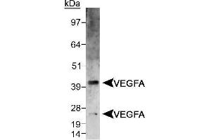 Image no. 2 for anti-Vascular Endothelial Growth Factor A (VEGFA) (AA 150-250), (Internal Region) antibody (ABIN363519) (VEGFA Antikörper  (Internal Region))