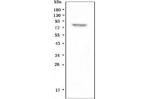 Western blot analysis of GPCR LGR8 using anti-GPCR LGR8 antibody (ABIN6719634).