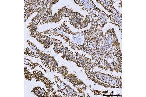 IHC analysis of Annexin A10/ANXA10 using anti-Annexin A10/ANXA10 antibody (ABIN7601853). (Annexin a10 Antikörper  (AA 49-324))