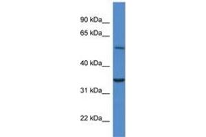 Image no. 1 for anti-Cytochrome B5 Reductase 4 (CYB5R4) (N-Term) antibody (ABIN6746476) (CYB5R4 Antikörper  (N-Term))