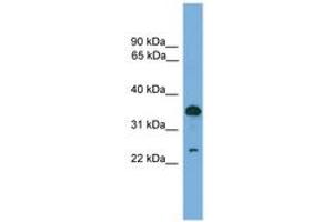 Image no. 1 for anti-Tumor Protein D52 (TPD52) (AA 81-130) antibody (ABIN6745546) (TPD52 Antikörper  (AA 81-130))