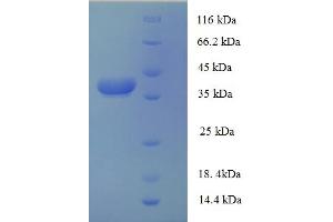 AP1S3 Protein (AA 1-104) (GST tag)