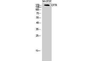 Western Blotting (WB) image for anti-Cystic Fibrosis Transmembrane Conductance Regulator (ATP-Binding Cassette Sub-Family C, Member 7) (CFTR) (Ser246) antibody (ABIN3183888) (CFTR Antikörper  (Ser246))