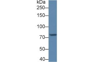 Detection of POSTN in BXPC3 cell lysate using Polyclonal Antibody to Periostin (POSTN) (Periostin Antikörper  (AA 370-494))