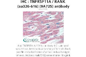 Image no. 1 for anti-Tumor Necrosis Factor Receptor Superfamily, Member 11a, NFKB Activator (TNFRSF11A) (AA 326-616) antibody (ABIN5693688)