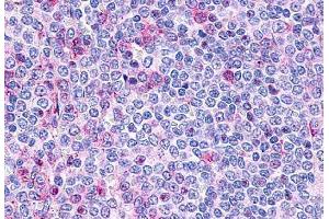 Anti-P2RY10 / P2Y10 antibody  ABIN1049202 IHC staining of human spleen, lymphocytes.