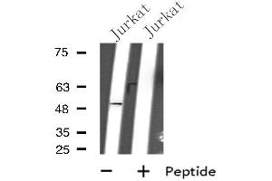Western blot analysis of extracts from Jurkat cells, using GPR152 antibody. (GPR152 Antikörper  (N-Term))