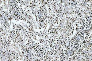 IHC analysis of GADD45B using anti-GADD45B antibody (ABIN7603219). (GADD45B Antikörper  (N-Term))
