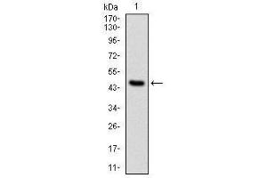 Western Blotting (WB) image for anti-Protein Phosphatase 2A Activator, Regulatory Subunit 4 (PPP2R4) antibody (ABIN1108715)